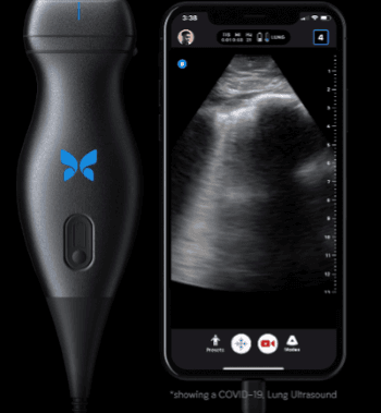 Image of a portable Butterfly lung ultrasound device 